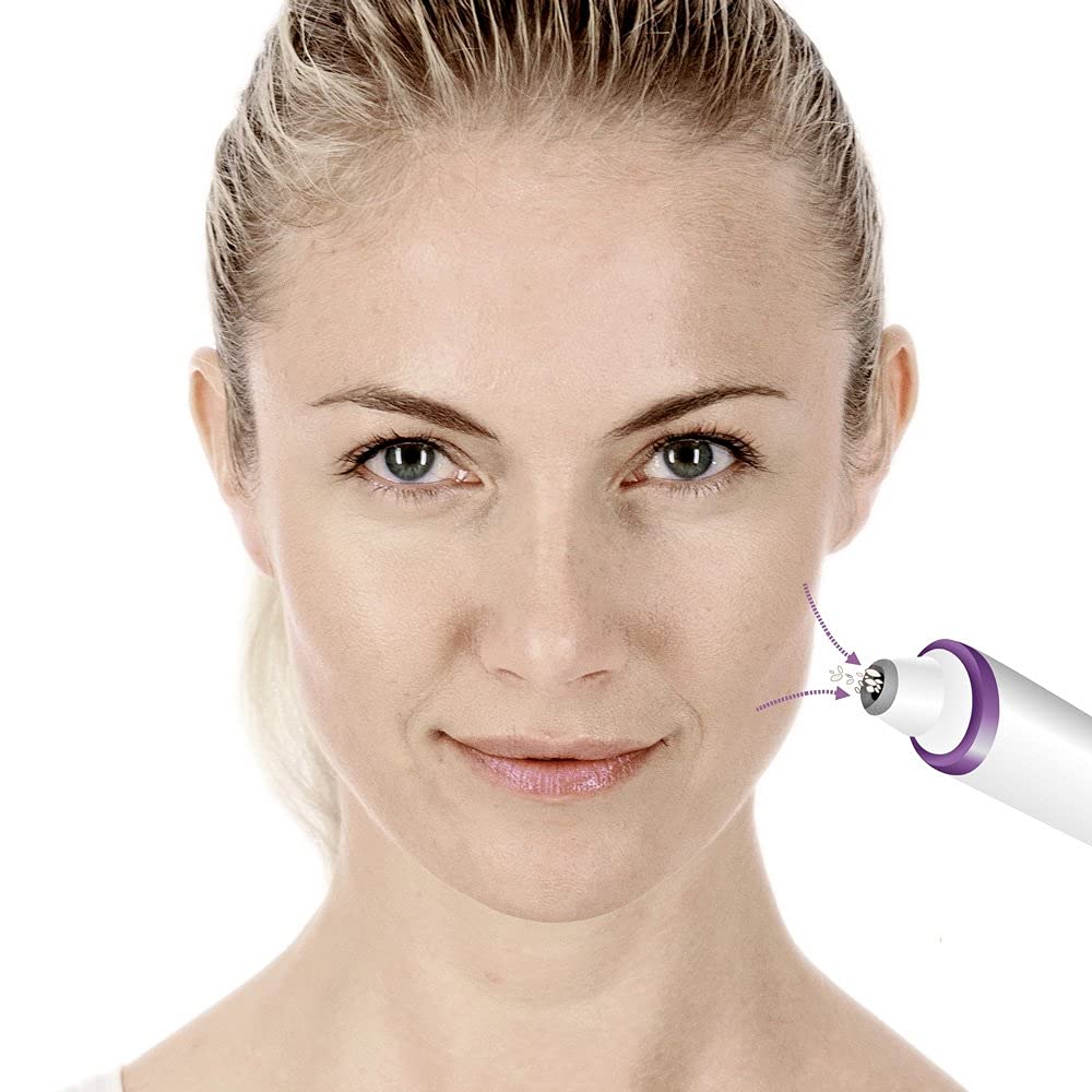 beurer-fc-76-microdermoabrasione-3-accessori-zaffiro-2-intensit image 4