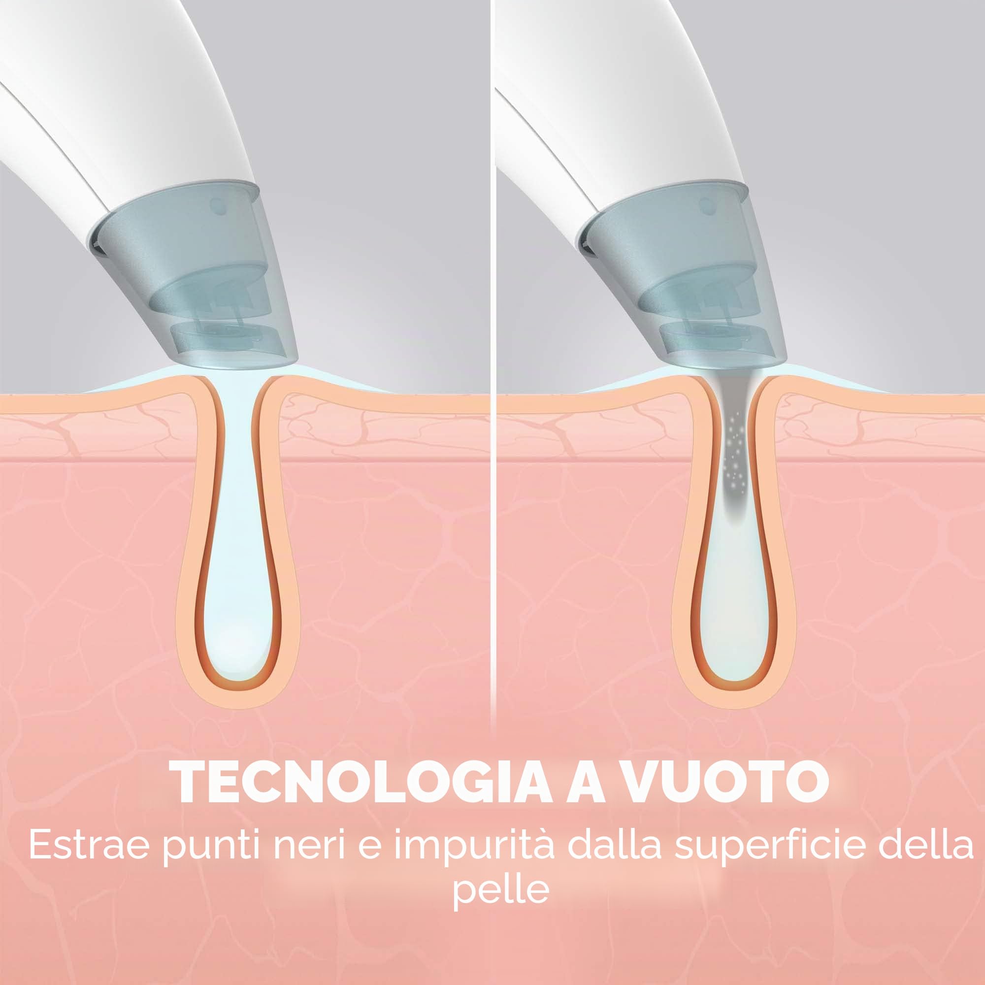 homedics-refresh-hydradermabrasion-cleanser-viso-con-3-programmi-e-6-ugelli image 4