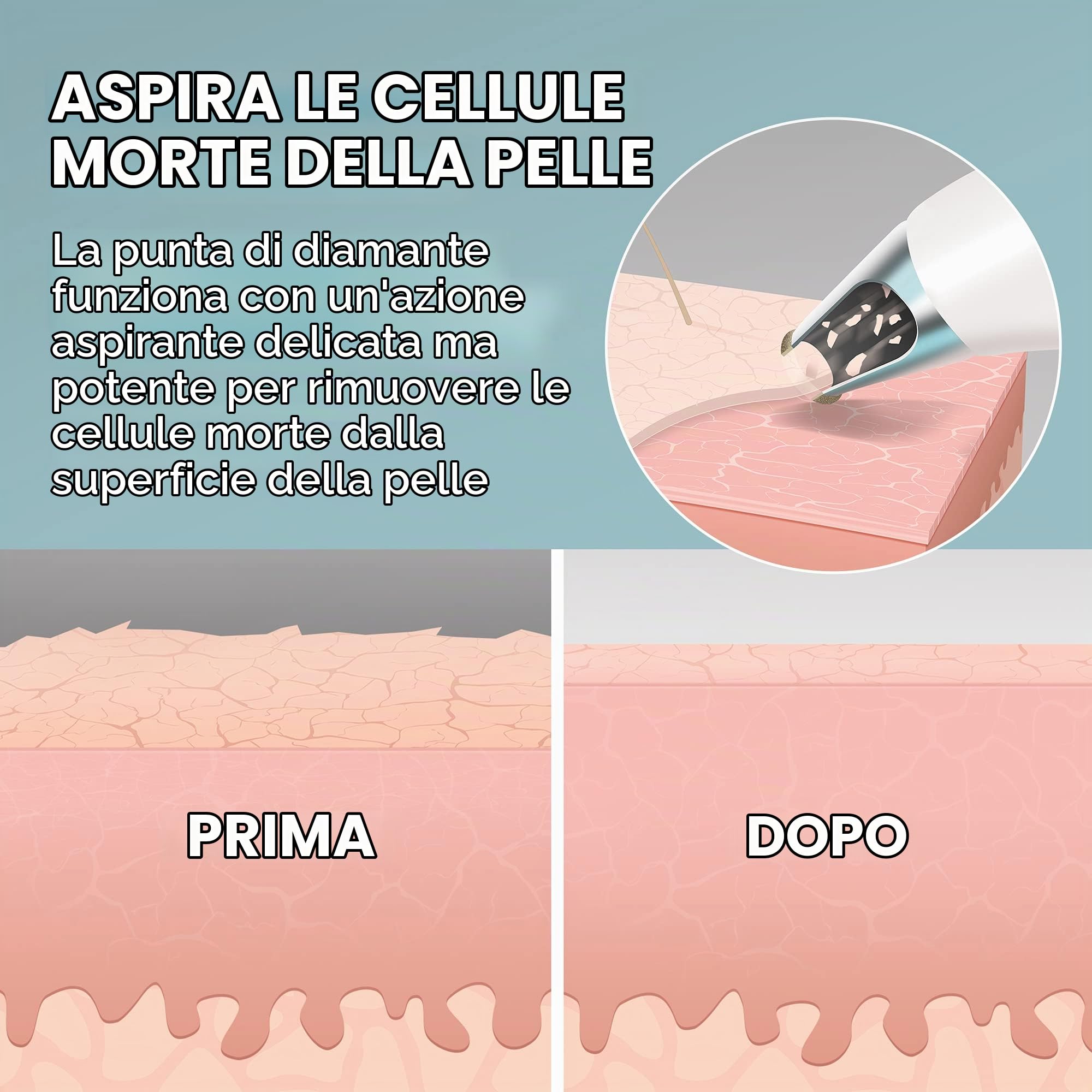 homedics-remove-microdermoabrasione-con-raffreddamento-e-4-intensit image 5