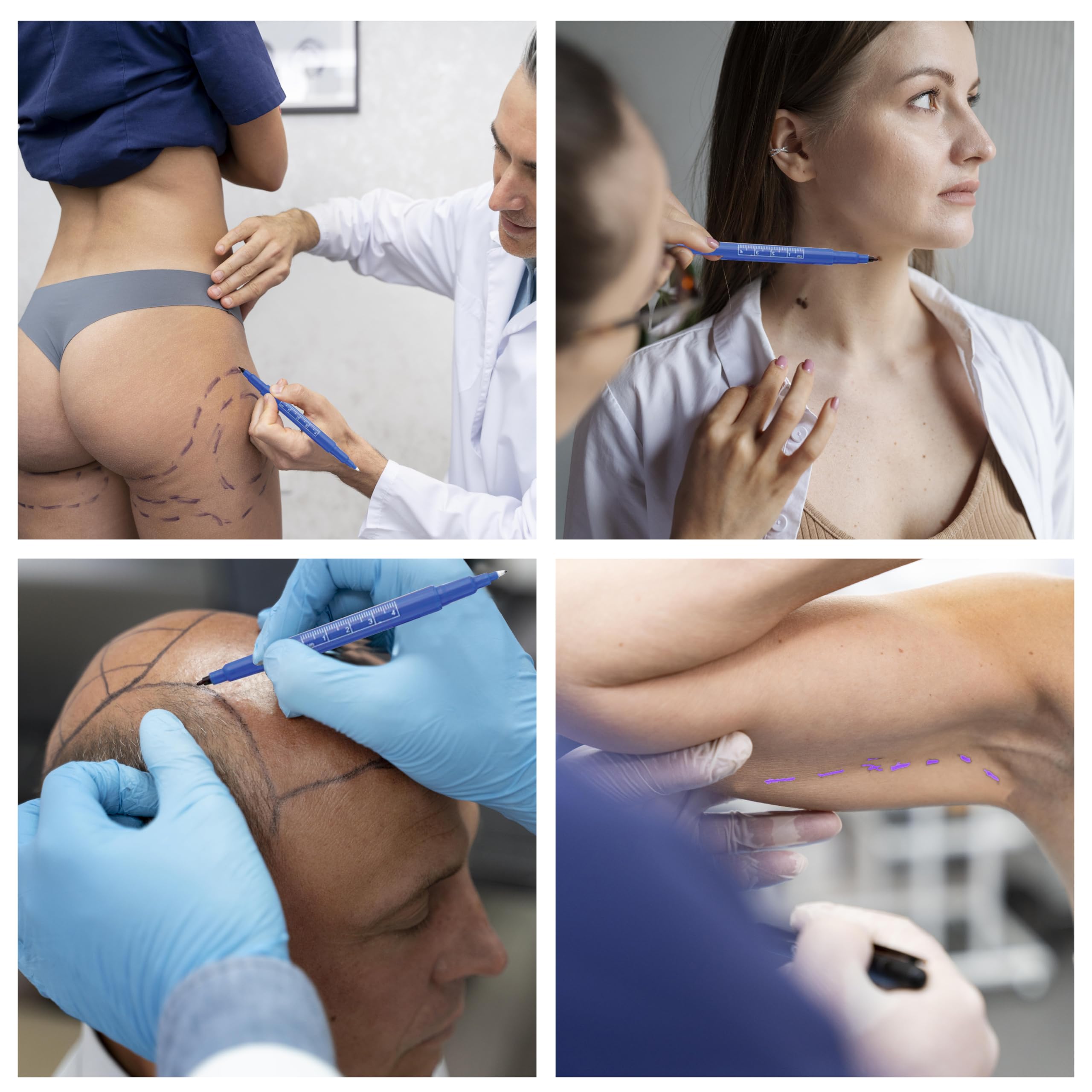 gima-penna-dermatologica-doppia-punta-confezione-da-10-per-marcatura-cutanea image 7